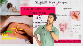 pain right lower abdomen  know the causes 🚨 [upl. by Foulk]