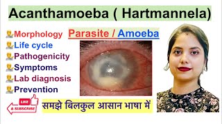 Acanthamoeba Hartmannela Parasite in Hindi  Life Cycle  Lab Diagnosis  Parasitology [upl. by Hiltner]