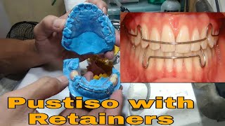 Pustiso with Retainer Upper and Lower Hawley Retainers Dentures with retainers [upl. by Fronniah313]