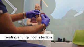 Flawless Feet foot and nail fungal infection advice [upl. by Nohj]