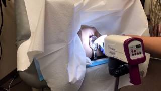 Colposcopy training video [upl. by Gnik]