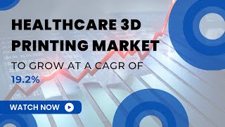 Healthcare 3D Printing Market Research Report  Quants and Trends  Healthcare Market Research [upl. by Hsirehc]