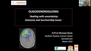 Dr Michael Back  Oligodendroglioma Education Day [upl. by Wertz443]