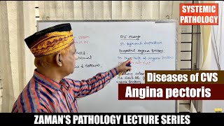 Systemic Pathology Lecture 34  Diseases of CVS  Day 04  Angina pectoris [upl. by Ulrika161]