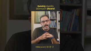 How to know if you have Stomach Ulcer  Dr Deepak Subramanian [upl. by Elletsirk126]