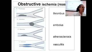 About Abnomality of periferal blood flow in 3 min Professor Maksimovich N Ye [upl. by Euqinamod518]