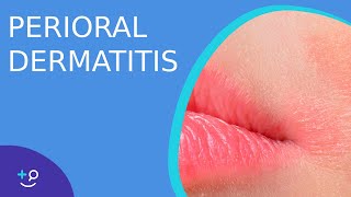 Perioral Dermatitis  Daily Dos of Dermatology [upl. by Hengel785]