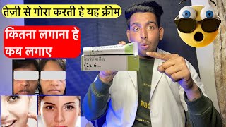 तेजी से गोरा करने वाली क्रीम  Ga 6 cream review  Glycolic acid cream 6 ww  Ga 6 cream how to use [upl. by Coveney]