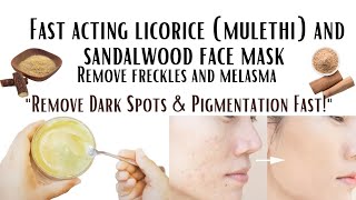 Remove Melasma Freckles Dark Spots and Hyperpigmentation FastquotNatural DIY Fast acting face mask [upl. by Iluj]