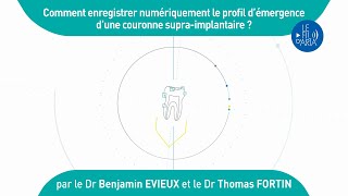 Comment enregistrer numériquement le profil démergence dune couronne supraimplantaire [upl. by Gloriana]