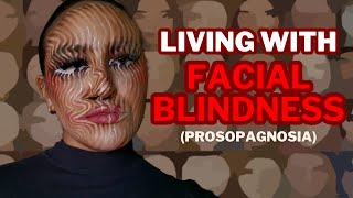 Living with Facial Blindness Prosopagnosia [upl. by Leik409]