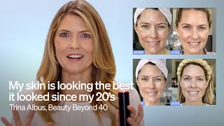 Beauty Beyond 40 Trina Albus Reviews The LYMA Laser [upl. by Nwadrebma49]