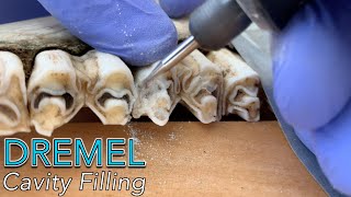 Filling a Cavity Between Teeth with a Dremel Parody [upl. by Brindle614]