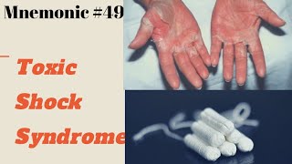 TOXIC SHOCK SYNDROME Mnemonic [upl. by Tirzah]