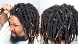 He has PAINFUL SCALP FLAKES TRANSFORMATION [upl. by Tallie]