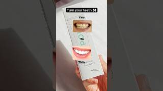 Want white teeth 😁 then watch this toothpaste toothcare teethwhitening collab ugc ad [upl. by Claudetta]