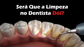 Como é Feita a Limpeza no Dentista  Remoção De Tártaro [upl. by Fiel774]