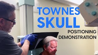 Townes Skull Radiographic Positioning Demonstration [upl. by Marlee]