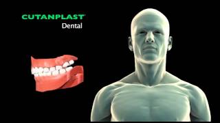 CUTANPLASTdentalENsurgery [upl. by Rodge]