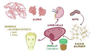 Glucose 6 phosphate dehydrogenase deficiency [upl. by Domineca784]