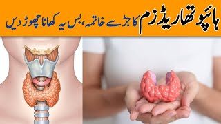 Hypothyroidism Causes Symptoms amp Treatment  Food To Avoid In Thyroid  Dr YK [upl. by Hahcim182]