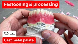 FESTOONING AND PROCESSING AN UPPER DENTURE CAST METAL PALATE waxbae [upl. by Dnalel]