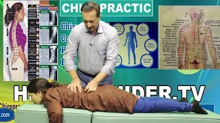 Adjustment Of Spine  Overcoming a severe spinal deformity  By Chiropractor Javed Mirza [upl. by Kellen509]