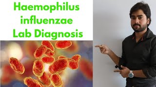 HAEMOPHILUS INFLUENZAE  Lab Diagnosis By Abhishek sir [upl. by Garrek]