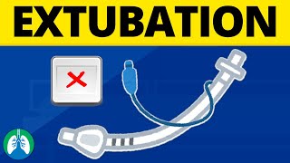 Extubation Medical Definition  Quick Explainer Video [upl. by Madanhoj]