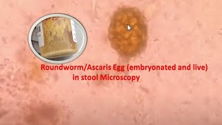 Roundworm or Ascaris Egg in stool Microscopy [upl. by Kcirrek]