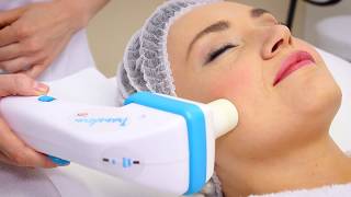 Antiageing facial treatments  Skin Renewal [upl. by Kidder]