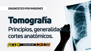 Curso Diagnostico por Imágenes  5° Clase Tomografía Principios generalidades cortes anatómicos [upl. by Aldis]