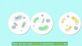 Understanding Episiotomy [upl. by Maxy240]