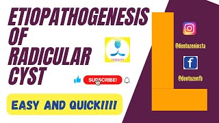 Etiopathogenesis of Radicular Cyst  Phases of Radicular Cyst  Pathogenesis of Radicular Cyst [upl. by Allerbag]