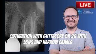 🔴Rtx of 26 with quotAcutequot Irreversible Pulpitis and calcified canals ▶️ Part 2 [upl. by Leinto]