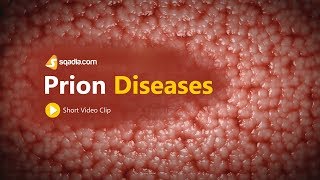 Prion Diseases  Neurology Medicine Animation  VLearning  sqadiacom [upl. by Opiak]