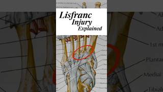 🚨 Understanding DeMarcus Lawrences Lisfranc Injury✨ [upl. by Belen24]