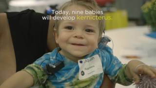 What if a word could save 9 babies a day Kernicterus [upl. by Zacks]