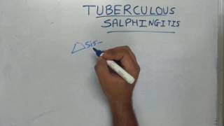 Tuberculous Salphingitis [upl. by Leler780]