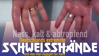 Extreme Schweißhände Handschweiß Sascha Ballweg Hyperhidrose HyperhidrosisPalmaris [upl. by Anadal]