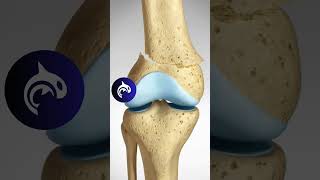 See how a Supracondylar Fracture of the Knee and Surgical Fixation works in 3D Animation [upl. by Euqinna442]