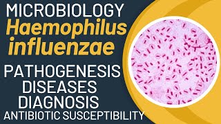 Haemophilus influenzae microbiology  Haemophilus influenzae pathogenesis [upl. by Nnayram]