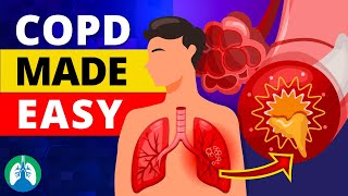 COPD Made Easy  Types Causes Symptoms and Treatment [upl. by Euqilegna329]