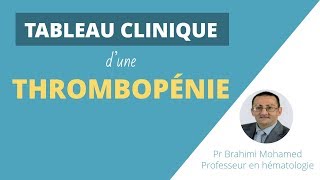 TABLEAU CLINIQUE DUNE THROMBOPENIE [upl. by Alyworth]