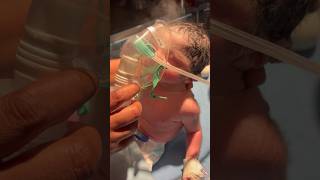 Giving NEBULIZATIONmedical newborn baby viral [upl. by Kieffer]