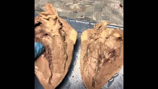 sheep heart dissection [upl. by Evod344]