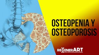 Osteopenia y Osteoporosis [upl. by Vilhelmina596]