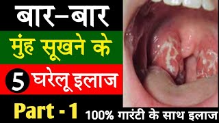 Part  1 Muh sukhna aur ghabrahat hona  Muh sukhne ka ilaj  Dry mouth causes remedies treatment [upl. by Eidas24]