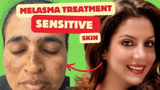 Melasma Treatment for Sensitive skin  Melasma Skincare Routine  Nipun Kapur [upl. by Groves347]