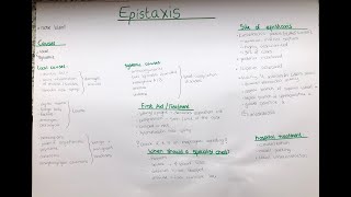 Epistaxis nose bleed  cause location vessels treatment consultation Littels area [upl. by Leith]